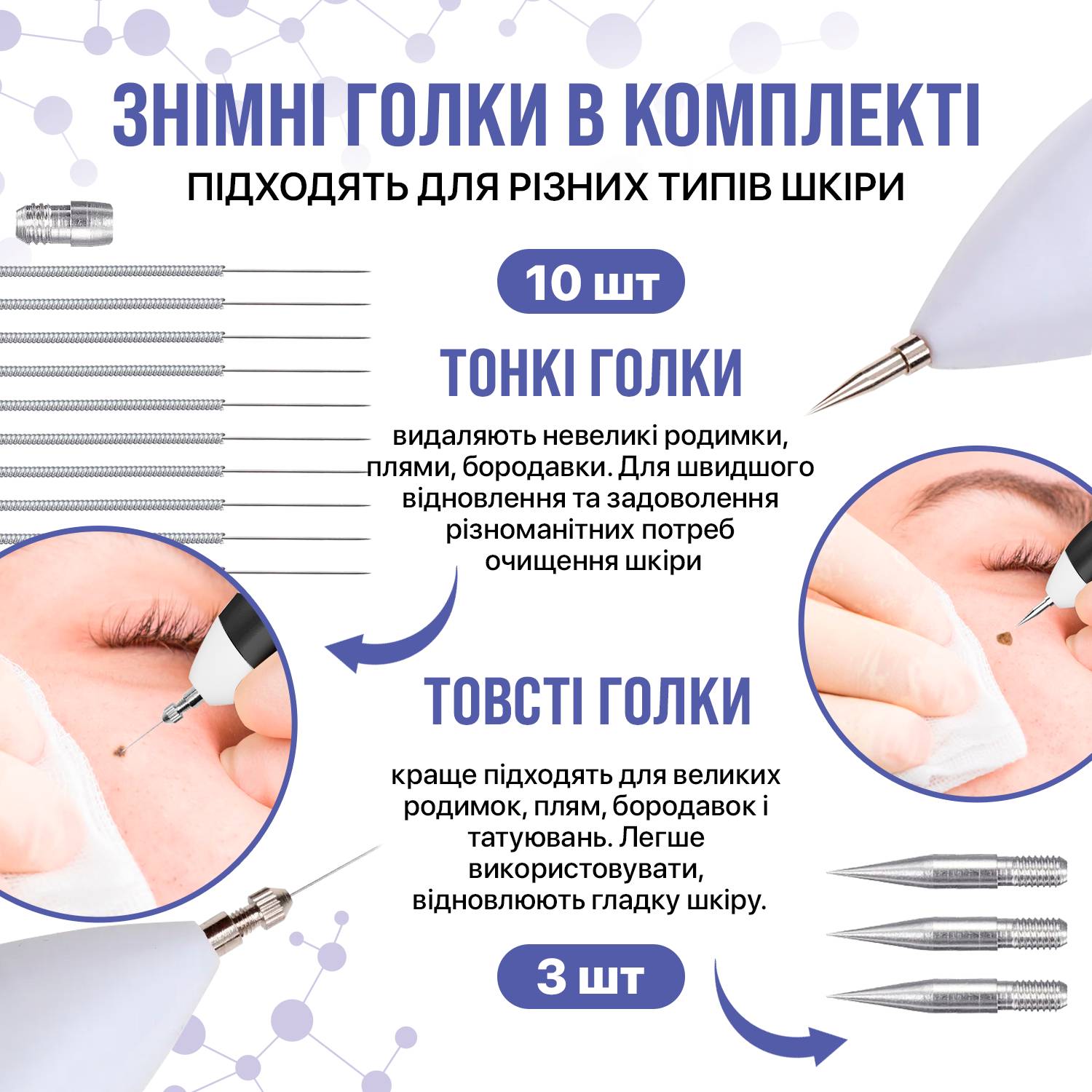 Электрокоагулятор плазменный прибор для удаления папиллом бородавок Plasma Pen SBT group XPREEN 070