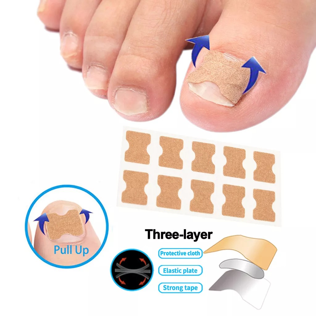 Набор для коррекции врастающих ногтей Elastic Toenail Correction Sticker 50 шт Бежевый (2104618421)