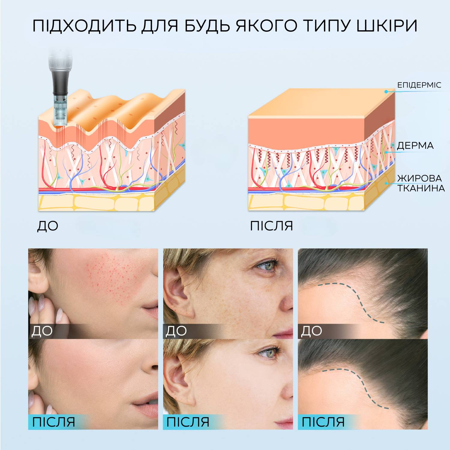 Беспроводной автономный дермапен для мезотерапии лица и тела Dr. Pen M7s электрический мезороллер Чёрный (1028)