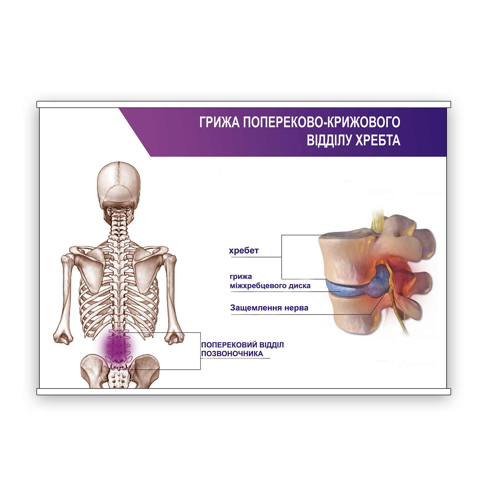 Плакат Vivay “Грижа попереково-крижового відділу хребета” А1 (8912)