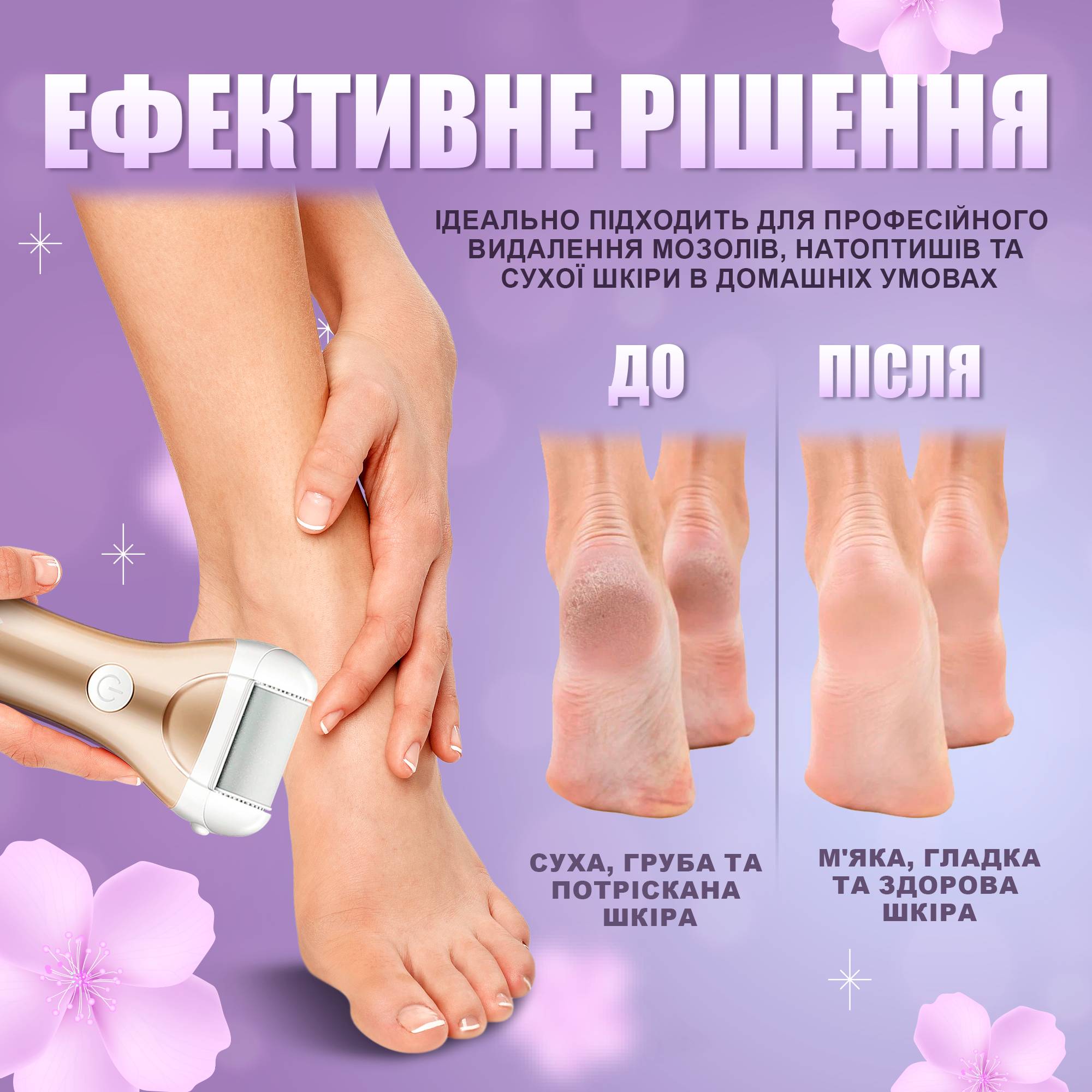 Электрическая роликовая пилка-пемза SBT group с функцией самоочищения и аккумулятором Золото